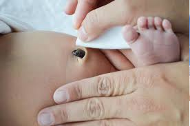 Cuidado del muñón umbilical del recién nacido: limpieza suave en la base del ombligo.