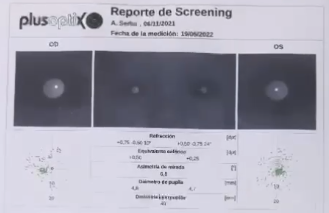 Reporte de tamizaje visual pediátrico realizado con equipo plusoptiX: medición de refracción y diámetro pupilar de ambos ojos.