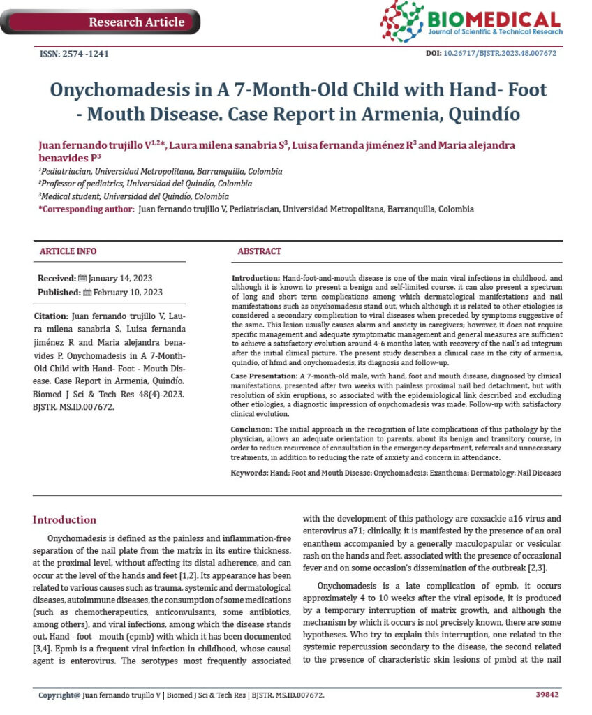 Primera página del artículo científico: Onychomadesis in a 7-Month-Old Child with Hand-Foot-Mouth Disease. Case Report in Armenia, Quindío — Biomedical Journal of Scientific & Technical Research.