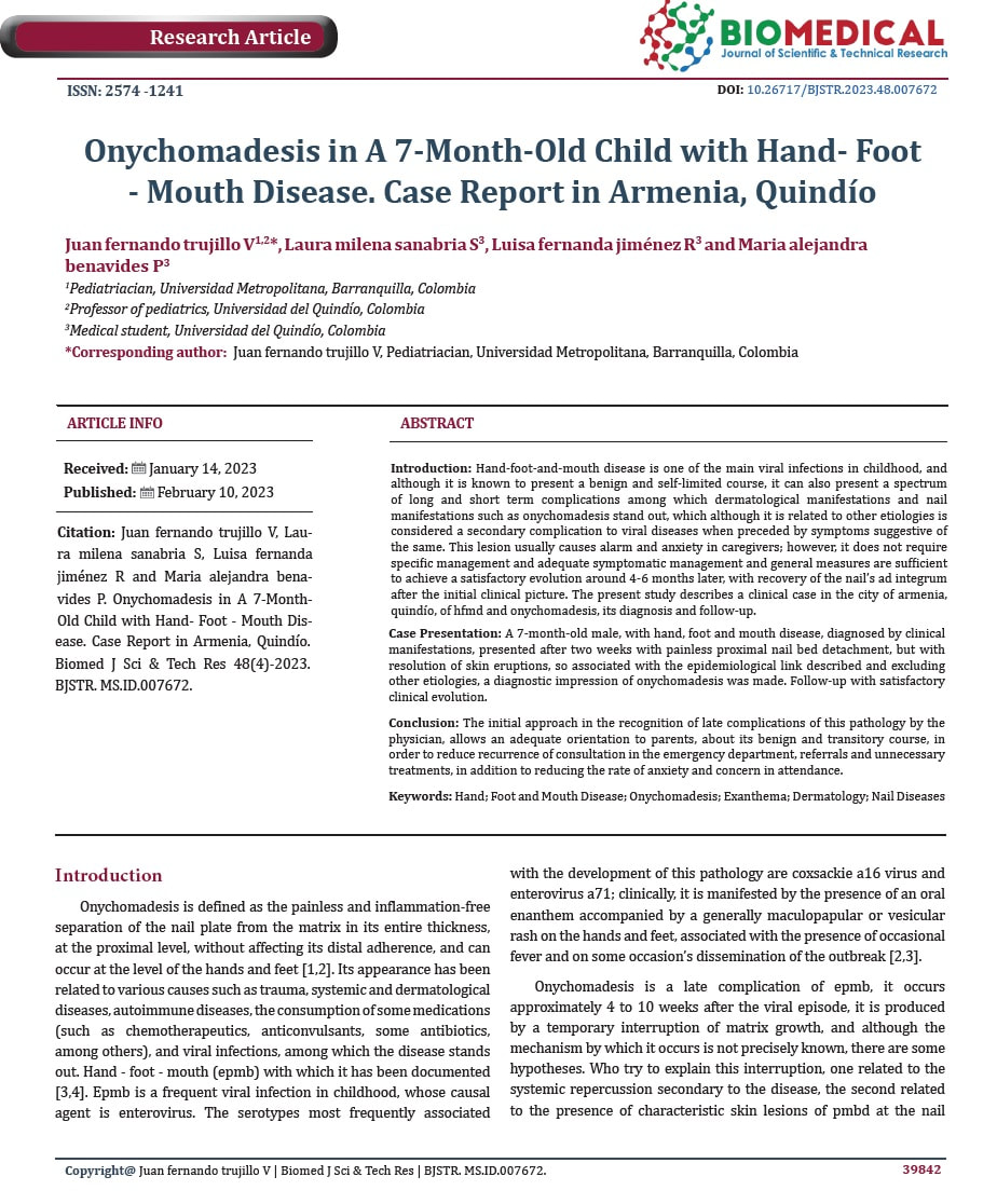 Primera página del artículo científico: Onychomadesis in a 7-Month-Old Child with Hand-Foot-Mouth Disease. Case Report in Armenia, Quindío — Biomedical Journal of Scientific & Technical Research.